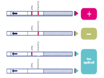Test de dépsitage rapide de l'angine à streptocoque A - Toda Pharma